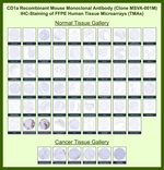 CD1a/HTA1 (Mature Langerhans Cells Marker) Recombinant Mouse Monoclonal Antibody (MSVA-001M)