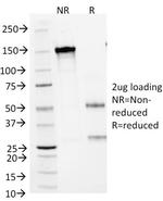 CD1a/HTA1 (Mature Langerhans Cells Marker) Antibody in SDS-PAGE (SDS-PAGE)