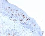 CD1a/HTA1 (Mature Langerhans Cells Marker) Antibody in Immunohistochemistry (Paraffin) (IHC (P))