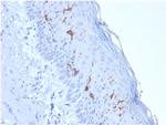 CD1a/HTA1 Antibody in Immunohistochemistry (Paraffin) (IHC (P))