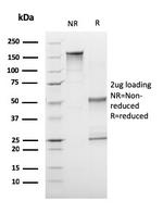 CD1a/HTA1 (Mature Langerhans Cells Marker) Antibody in SDS-PAGE (SDS-PAGE)
