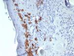 CD1a/HTA1 (Mature Langerhans Cells Marker) Antibody in Immunohistochemistry (Paraffin) (IHC (P))