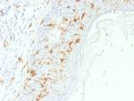 CD1a/HTA1 (Mature Langerhans Cells Marker) Polyclonal Antibody