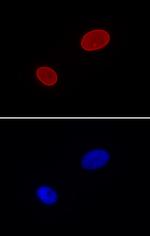 Lamin A/C Antibody in Immunocytochemistry (ICC/IF)