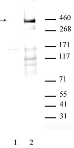 Phospho-ATM (Ser1981) Antibody in Western Blot (WB)