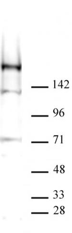 KDM5A Antibody in Western Blot (WB)