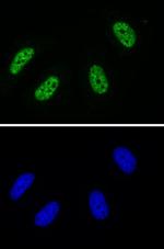 Phospho-RNA Pol II CTD (Tyr1) Antibody in Immunocytochemistry (ICC/IF)