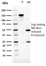 PDZ and LIM Domain 1 Antibody in SDS-PAGE (SDS-PAGE)