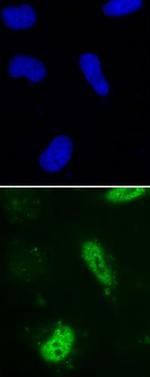 BrdU Antibody in Immunocytochemistry (ICC/IF)
