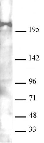 Mi-2 beta (CHD4) Antibody in Western Blot (WB)