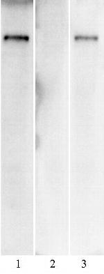 SARS-CoV-2 Spike Antibody in Western Blot (WB)