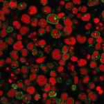 CD2/Lymphocyte Function Antigen 2 (LFA-2) Antibody in Immunocytochemistry (ICC/IF)