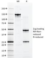 CD2/Lymphocyte Function Antigen 2 (LFA-2) Antibody in SDS-PAGE (SDS-PAGE)