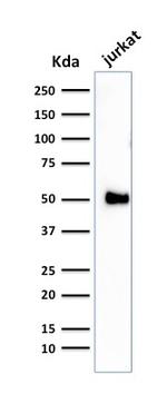 CD2/Lymphocyte Function Antigen 2 (LFA-2) Antibody in Western Blot (WB)