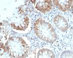 CD2/Lymphocyte Function Antigen 2 (LFA-2) Antibody in Immunohistochemistry (Paraffin) (IHC (P))