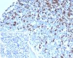 CD2/Lymphocyte Function Antigen 2 (LFA-2) Antibody in Immunohistochemistry (Paraffin) (IHC (P))