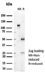 CD2/Lymphocyte Function Antigen 2 (LFA-2) Antibody in SDS-PAGE (SDS-PAGE)