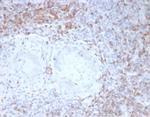 CD2/Lymphocyte Function Antigen 2 (LFA-2) Antibody in Immunohistochemistry (Paraffin) (IHC (P))