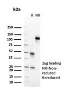 CD2/Lymphocyte Function Antigen 2 (LFA-2) Antibody in SDS-PAGE (SDS-PAGE)