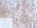 CD2/Lymphocyte Function Antigen 2 (LFA-2) Antibody in Immunohistochemistry (Paraffin) (IHC (P))