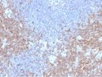CD2/Lymphocyte Function Antigen 2 (LFA-2) Antibody in Immunohistochemistry (Paraffin) (IHC (P))