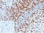 CD2/Lymphocyte Function Antigen 2 (LFA-2) Antibody in Immunohistochemistry (Paraffin) (IHC (P))