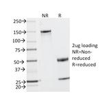 CD2/Lymphocyte Function Antigen 2 (LFA-2) Antibody in SDS-PAGE (SDS-PAGE)