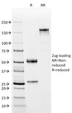 CD2/Lymphocyte Function Antigen 2 (LFA-2) Antibody in SDS-PAGE (SDS-PAGE)