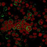 CD2/Lymphocyte Function Antigen 2 (LFA-2) Antibody in Immunocytochemistry (ICC/IF)