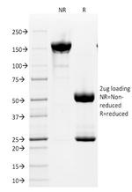 CD2/Lymphocyte Function Antigen 2 (LFA-2) Antibody in SDS-PAGE (SDS-PAGE)