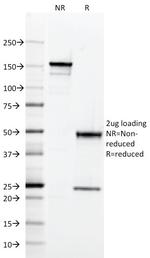 CD2/Lymphocyte Function Antigen 2 (LFA-2) Antibody in SDS-PAGE (SDS-PAGE)