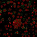 CD2/Lymphocyte Function Antigen 2 (LFA-2) Antibody in Immunocytochemistry (ICC/IF)