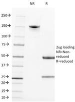 CD2/Lymphocyte Function Antigen 2 (LFA-2) Antibody in SDS-PAGE (SDS-PAGE)