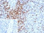 CD2/Lymphocyte Function Antigen 2 (LFA-2) Antibody in Immunohistochemistry (Paraffin) (IHC (P))