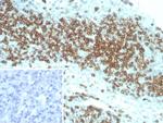 CD2/Lymphocyte Function Antigen 2 (LFA-2) Antibody in Immunohistochemistry (Paraffin) (IHC (P))