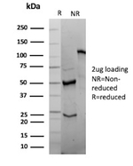 CD2/Lymphocyte Function Antigen 2 (LFA-2) Antibody in SDS-PAGE (SDS-PAGE)