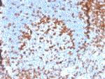 CD2/Lymphocyte Function Antigen 2 (LFA-2) Antibody in Immunohistochemistry (Paraffin) (IHC (P))