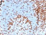 CD2/Lymphocyte Function Antigen 2 (LFA-2) Antibody in Immunohistochemistry (Paraffin) (IHC (P))