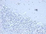 CD2/Lymphocyte Function Antigen 2 (LFA-2) Antibody in Immunohistochemistry (Paraffin) (IHC (P))