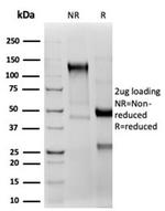 CD2/Lymphocyte Function Antigen 2 (LFA-2) Antibody in SDS-PAGE (SDS-PAGE)