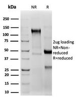 CD2/Lymphocyte Function Antigen 2 (LFA-2) Antibody in SDS-PAGE (SDS-PAGE)