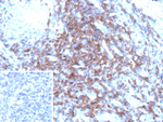CD3D/T Cell Receptor delta Antibody in Immunohistochemistry (Paraffin) (IHC (P))