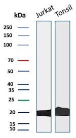 CD3D/T Cell Receptor delta Antibody in Western Blot (WB)