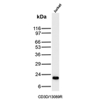 CD3D/T Cell Receptor delta Antibody in Western Blot (WB)