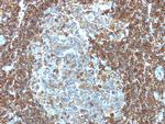 CD3e (T-Cell Marker) Antibody in Immunohistochemistry (Paraffin) (IHC (P))