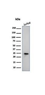 CD3e (T-Cell Marker) Antibody in Western Blot (WB)