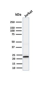 CD3e (T-Cell Marker) Antibody in Western Blot (WB)