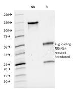 CD3e (T-Cell Marker) Antibody in SDS-PAGE (SDS-PAGE)