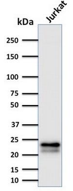 CD3e (T-Cell Marker) Antibody in Western Blot (WB)