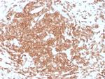 CD3e (T-Cell Marker) Antibody in Immunohistochemistry (Paraffin) (IHC (P))